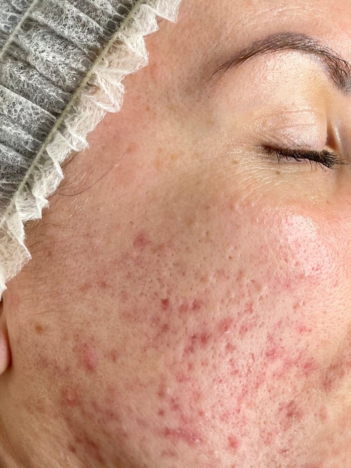 Before